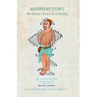 Acupuncture – The ancient art of healing
